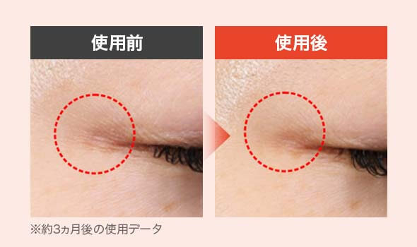 エンリッチ 目元のシワBA