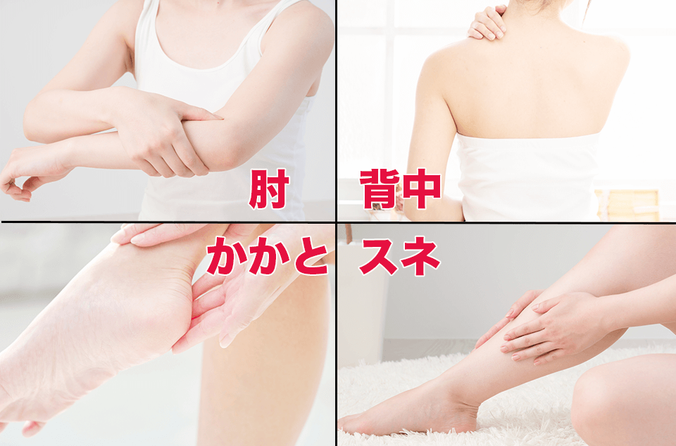 ヒアロモイスチャー240