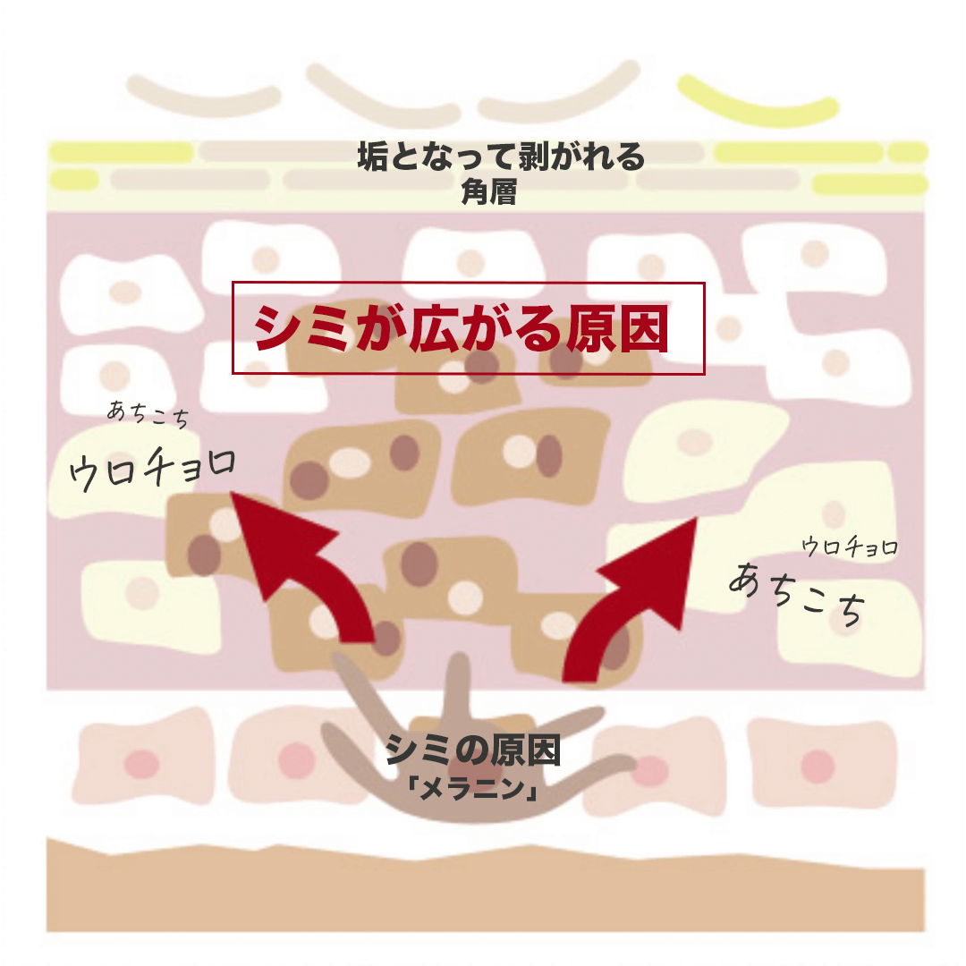 ドレススノーハーフ川野