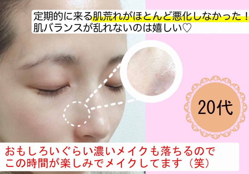 アテニアオレンジボトル　口コミ①