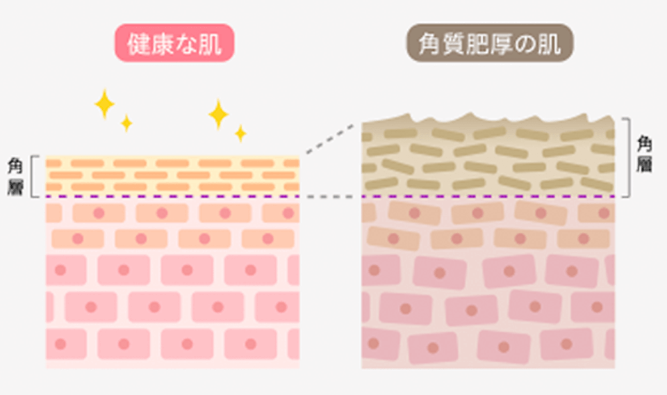 プライマーショット