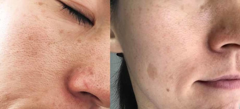 ブライトエイジ シミしわ