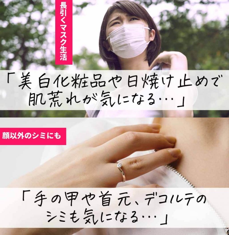 ブライトエイジホワイト　マスク生活　全身美白