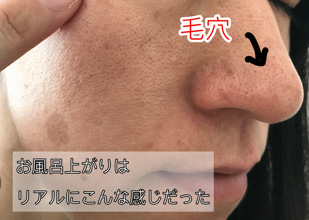 アテニアオレンジボトル　毛穴悩み