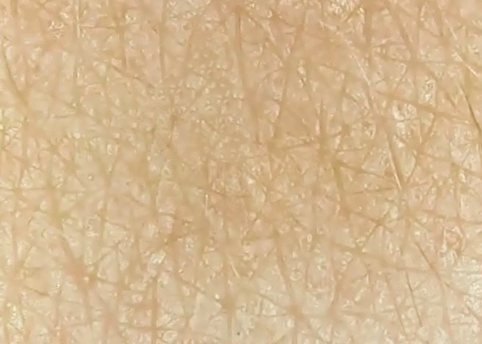 肌ナチュール　毛穴効果