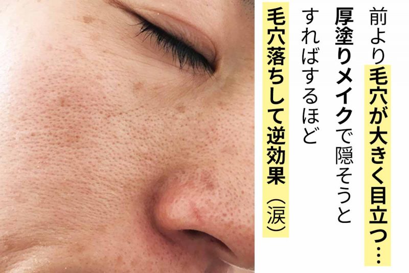 オラクル　大人の毛穴事情