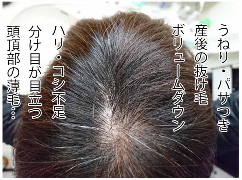 リリィジュ 髪のエイジング