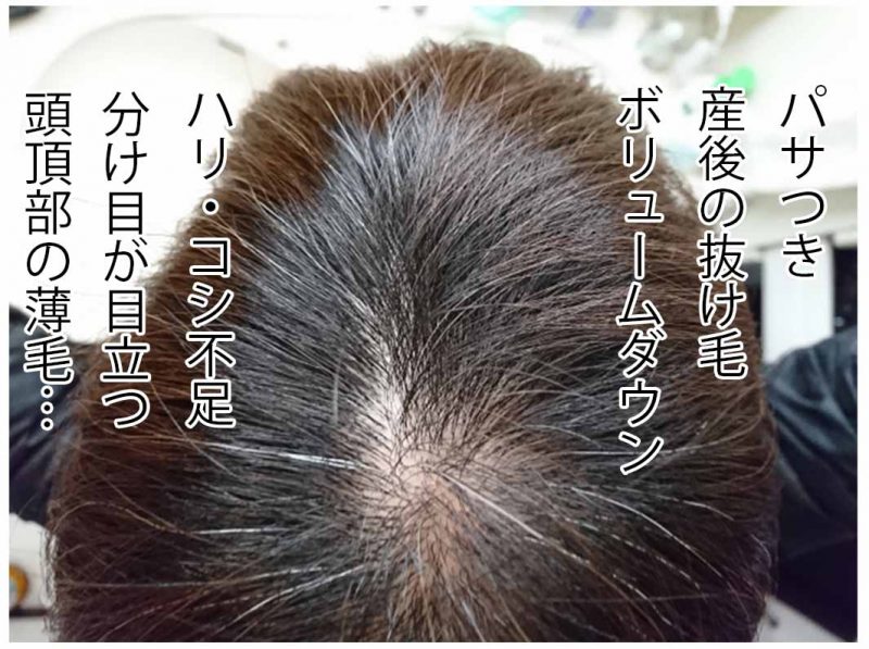 リリィジュ　髪のエイジング