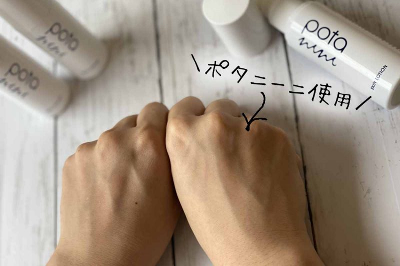 ポタニーニ アフター 両手比較